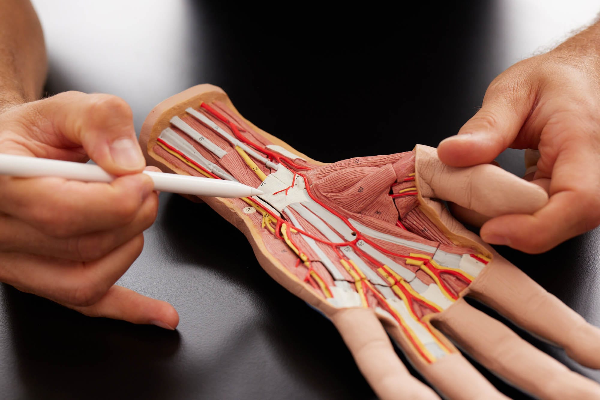 Ein Arzt zeigt mit einem weißen Stift auf ein detailliertes Modell einer geöffneten Hand mit Muskeln, Sehnen und Nerven.